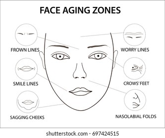 Woman's face with the places where wrinkles appear with age. Girls face aging zones: worry lines, nasolabial folds, crow's feet, drooping chin Wrinkled face. 