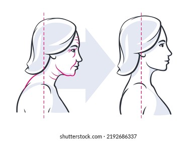 Womans face profile before and after. Young and elderly image of skin aging. Vector illustration isolated on white background.