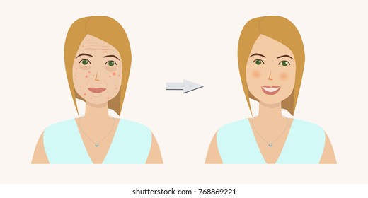 Woman's face with skin problems before and after skin treatment . Wrinckles, acne, pimples, dark circles under eyes. Skin troubles.  Vector illustration.