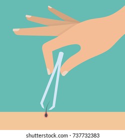 Woman's hand holding tweezers and pulling out a hair from the skin with it