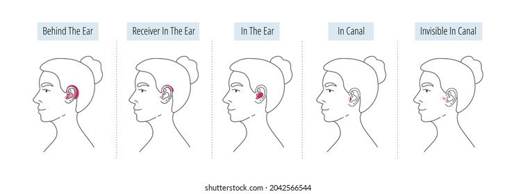 A woman's head with different types of hearing aids for the hearing impaired and the deaf.Different hearing aid technology.Hearing aid categories.Vector flat illustration.