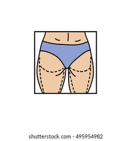 Woman's legs marked on hips. Plastic surgery concept