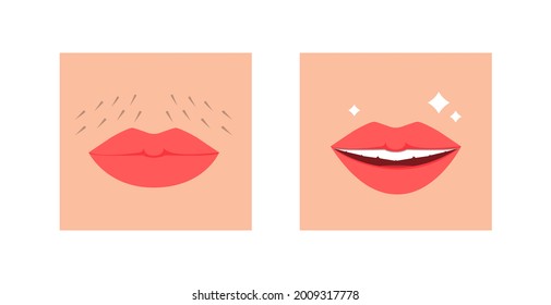 70 Hair Removal Upper Lip Stock Vectors, Images & Vector Art | Shutterstock