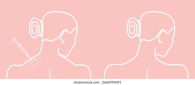 Woman's neck from behind before and after botulinum toxin. Vector illustration
