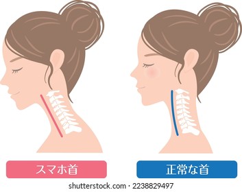 Woman's profile smartphone neck

In Japanese, it says "smartphone neck" and "normal cervical spine"