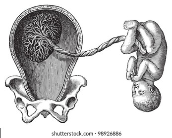 Womb with placenta and umbilical cord with child / vintage illustration from Die Frau als hausarztin 1911