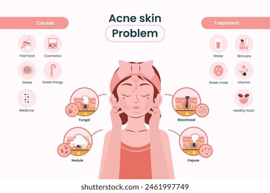 Women Acne Skin Problem Infographic