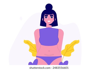 Mujeres con cicatriz de cesárea. Puntos después de la cesárea, concepto de cesárea. Ilustración plana de Vector aislado fondo blanco.