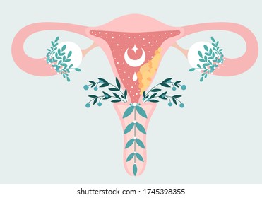 Women health. Floral Infographic of Endometrial Cancer - Carcinoma. Patient-friendly scheme of Gynecological cancerous tumor. Oncology in Female - Neutral medical diagram uterus and appendages