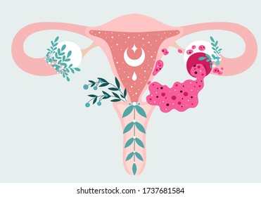 Gesundheit von Frauen - Blumeninformationen über Ovarialzystrisen mit Flüssigkeit. Patientenfreundliches Schema der Ovarialerkrankung. Gynäkologische Probleme - Uterus-Uterus-und Uterusapplikationen im neutralen medizinischen Diagramm