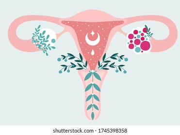 Women health - Floral Infographic of Polycystic ovary syndrome. Patient-friendly scheme of PCOS, Multifollicular cyst. Gynecological problems - Neutral medical diagram uterus and uterine appendages
