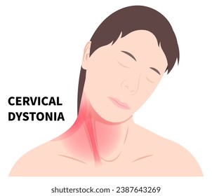 Women Neck muscle stiffness pain in adults or baby with chronic cervical dystonia disorder and the Torticollis of occupational therapy exercise svg