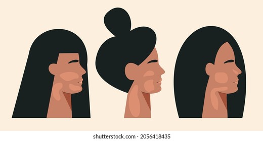 Women silhouette with vitiligo chronic skin pigmentation disorder. World vitiligo day concept. Portrait of girl with skin disease. Different Beauty. Flat vector illustration isolated white background