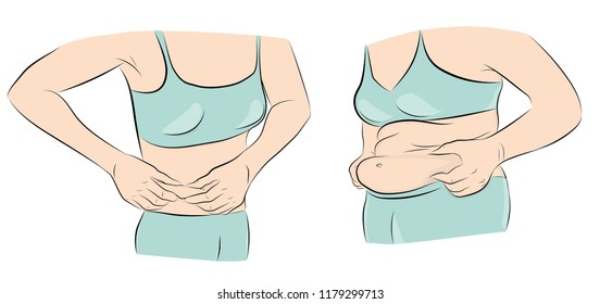 women with and without stomach. losing weight. excess weight. vector illustration.