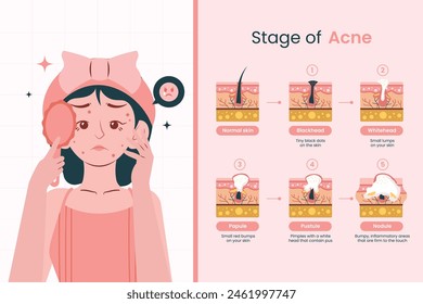 Women's Acne Skin Problem Stage Infographic