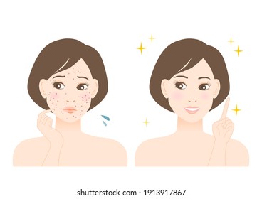 Women's beauty illustration. Trouble of pimple, spots and freckles. White background. vector illustration.