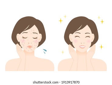 Women's beauty illustration. Trouble of pimple, spots and freckles. White background. vector illustration.