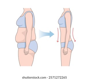 Women's body changes before and after fitness. Woman's body with fat belly and slender beautiful figure. Weight loss comparison