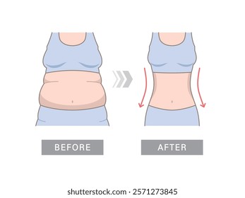 Women's body changes before and after fitness. Woman's body with fat belly and slender beautiful figure. Weight loss comparison