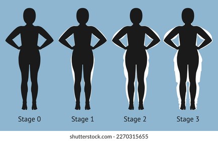 Women's body in different stages of Lipedema. Vector illustration