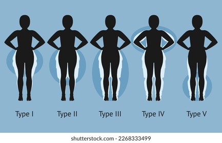 Women's body in different types of Lipedema. Vector illustration