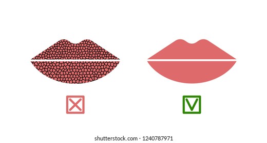 Womens dry chapped lips before and after cosmetic balm. Vector illustration