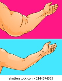 Women's hands with health problems. Healthcare illustration, medical infographics. Before, after. Vector illustration. svg