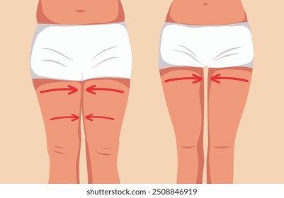 Las piernas de las mujeres antes y después de la pérdida de peso. Plantilla de Vector para publicidad, Sitio web, Anuncio, carteles, cubierta