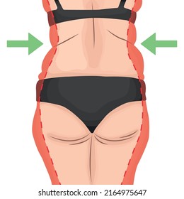 Women's thick ass with cut off on the sides of the extra parts. Weight loss concept.