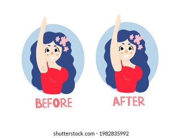Women's unshaven armpits. Feminism, women's freedom of choice. Design of posters of feminism. Body positive. Love your body. The procedure of depilation of the armpits. Advertising for hair removal.