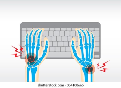 Working With Keyboard Long Time Is Cause Of Pain At Hand, Wrist, Bone, Joints And Muscle.