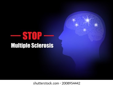 World brain day campaign 2021. Concept of stop multiple sclerosis. Vector illustration of human brain and astrocyte cells.
