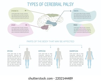 World Cerebral Palsy Day.infographic with a brain and the parts affected by the different types of paralysis as well as what part of the body is affected by each type.