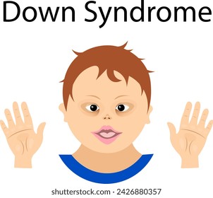 World Down syndrome day. Boy with Down syndrome and two palms. Down syndrome awareness concept.