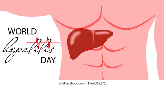 World Hepatitis Day. Vector illustrator