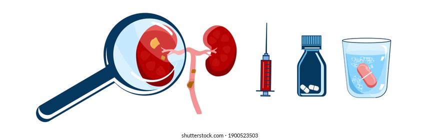 World Kidney day horizontal banner.Nephrology.Pyelonephritis and renal failure disease.Human organ,magnifier,glass of water with pill,tools.Stones,chronic illness.Problem with filtration.Vector