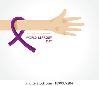 World Leprosy Day observed on last  Sunday of January every year