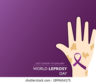 World Leprosy Day observed on last  Sunday of January every year