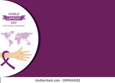 World Leprosy Day observed on last  Sunday of January every year