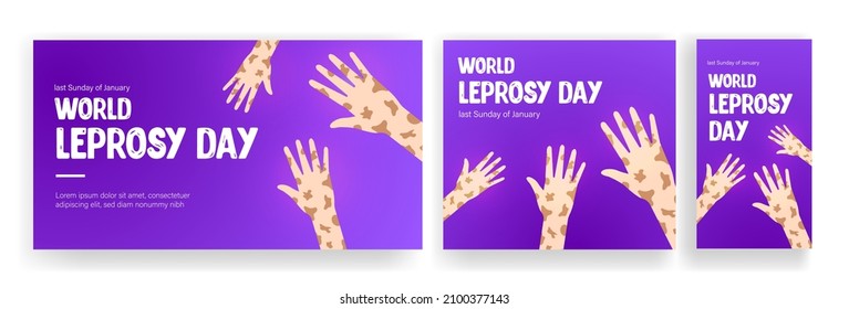 World Leprosy Day is observed on the last Sunday of January every year. World Leprosy Day Symbol for Social Media Template Banner, Cover, Story, Post.
