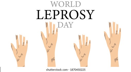 World Leprosy Day, Vektorgrafik, 31. Januar.
