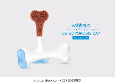 World Osteoporosis Day  Human bone anatomy  Unhealthy bone joint white background  Poster banner for website  Medical healthcare concept  Realistic 3d Vector illustration 