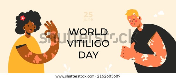World vitiligo day.\
25 june. Skin disorder. African woman and caucasian man gesturing\
ok and fine. Loss of melanin. Diversity, body positive, self\
acceptance concept. 