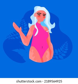 world vitiligo day another kind of beauty love yourself accept your body woman in bikini with vitiligo skin disease