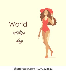World vitiligo day banner with vector illustration of woman in swimsuit with skin problems.