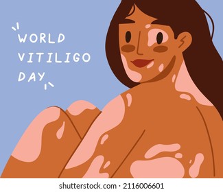 World Vitiligo Day banner. Young woman with vitiligo. Support people with chronic skin disorder. Accept your body. Beauty is diversity. Self acceptance, self love concept.