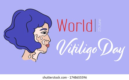 World Vitiligo Day. Bob hairstyle asian girl with pigment spots. Asian lady with vitiligo. Side view portrait of japanese woman - Isolated vector. Pale female face with genetic skin problem