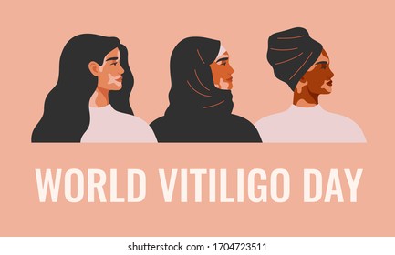 World Vitiligo day card with Three women with vitiligo of different nationalities standing together. Concept to support awareness about chronic skin disorder.Vector illustration