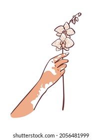 World Vitiligo Day. A concept on the topic of vitiligo disease. Flower in hand. Vector illustration.