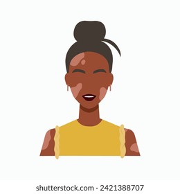 World vitiligo day concept. Portrait of a woman with vitiligo skin depigmentation. Body positive and inclusivity illustration